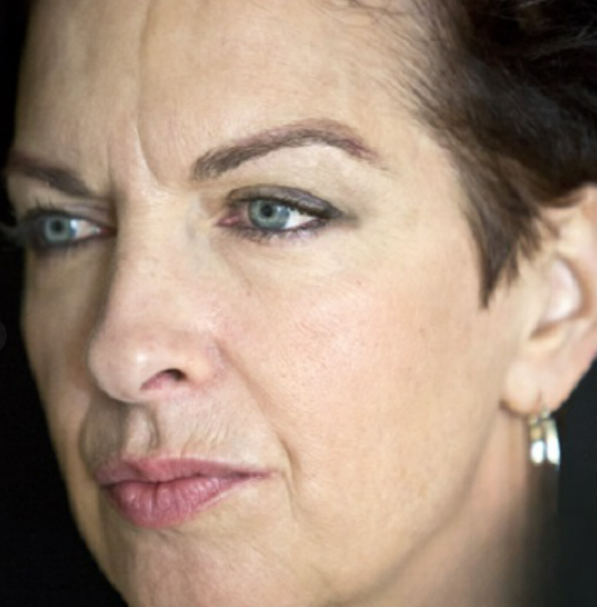 Original photo before Botox Glabella
