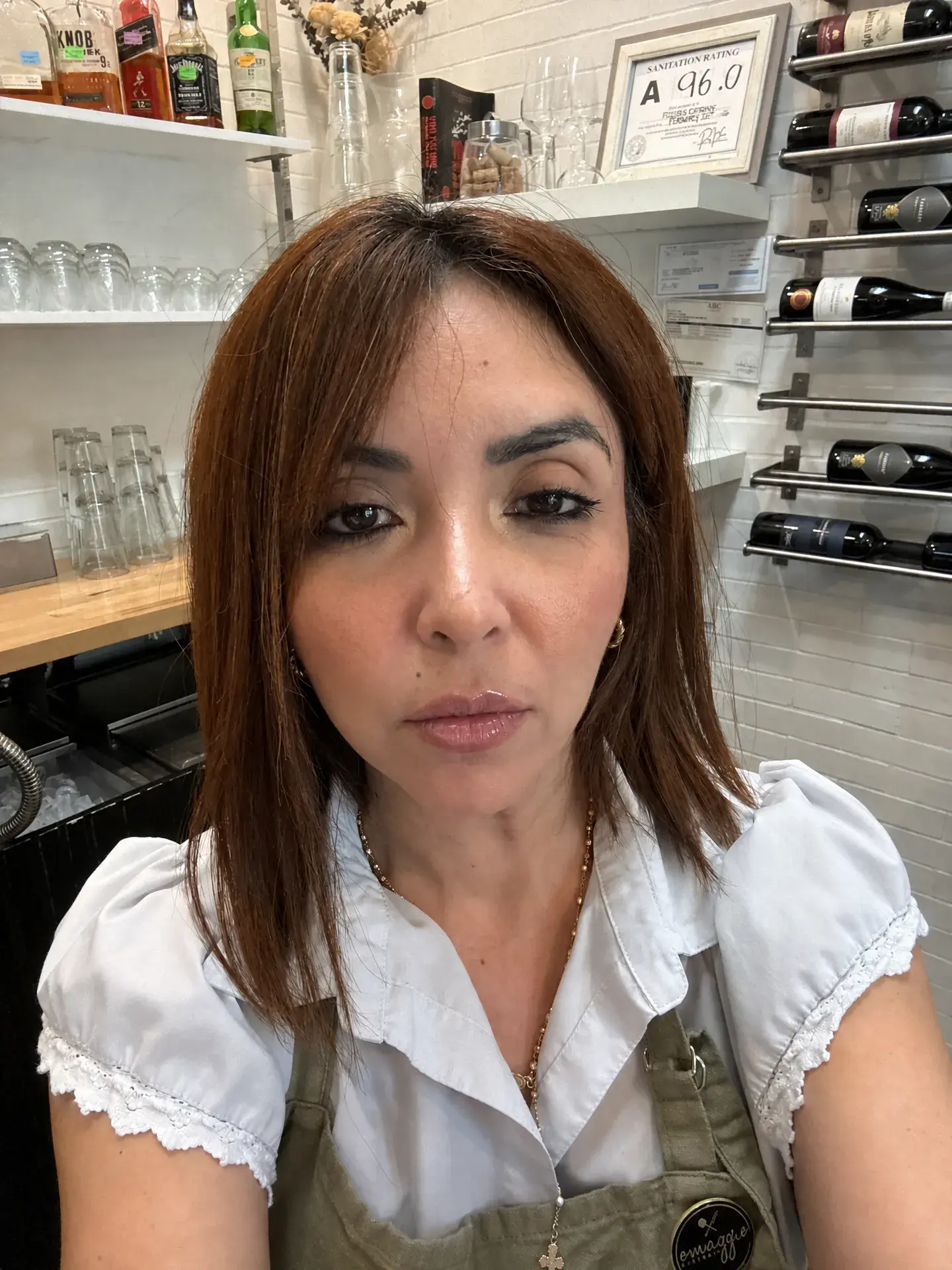 AI simulation of Lip Filler (subtle)
